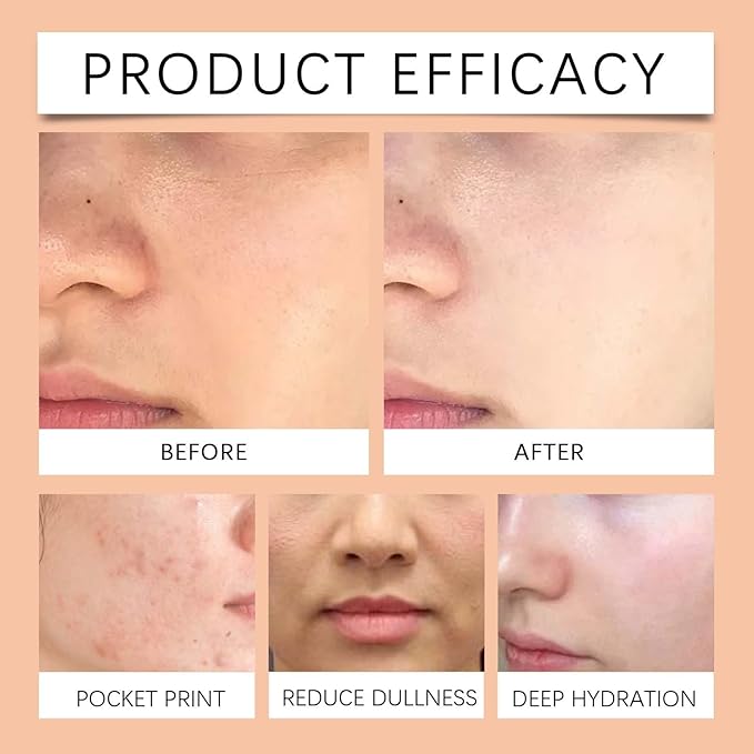 Moisturizing Toner - Gentle Hydration for Radiant, Clear Skin | Long-Lasting Moisture & Brightening Effect(1PCS)