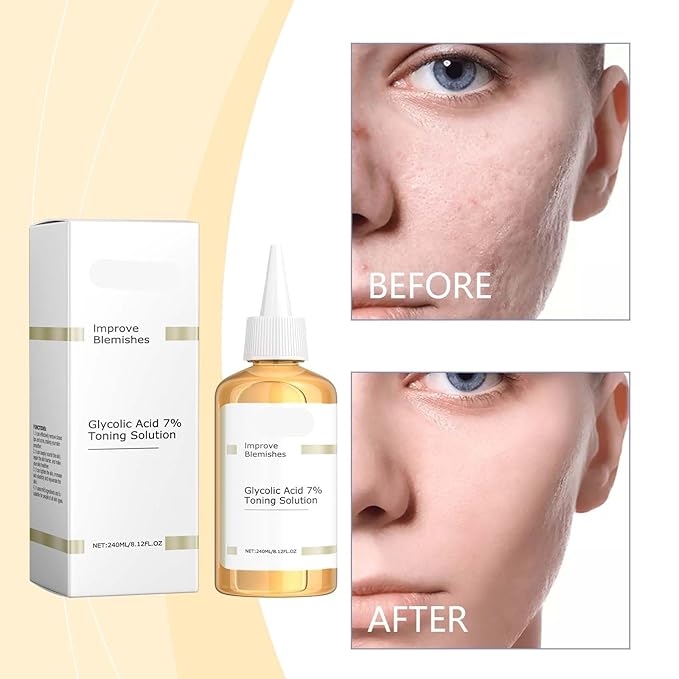 Gentle Toner for Skin Barrier Repair - Hydrating, Non-Greasy Facial Toner to Nourish & Fight Acne, Improve Skin Issues(1PCS)