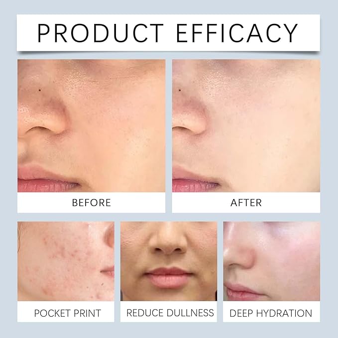 Exfoliating & Hydrating Toner - Gentle Exfoliation, Long-Lasting Moisture, Relieves Dry/Tight Skin, Improves Dry Texture(2PCS)