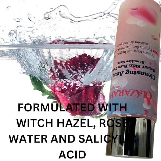 Skin-Clarifying Face Toner for Acne Treatment - Gentle on Sensitive Skin, Refreshes, Soothes, and Eliminates Acne, 4 Fl. oz