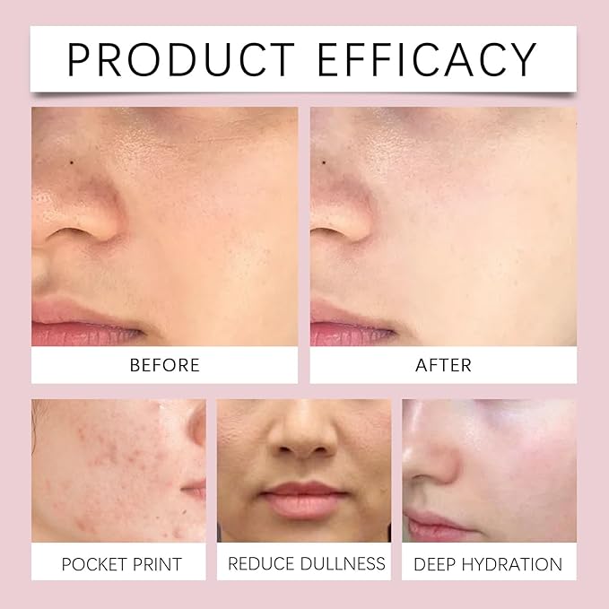Niacinamide Toner Spray With Rose & Aloe Extract - Locks Moisture, Relieves Dryness, Brightens Skin, Keeps Hydrated Smooth All Day(3PCS)