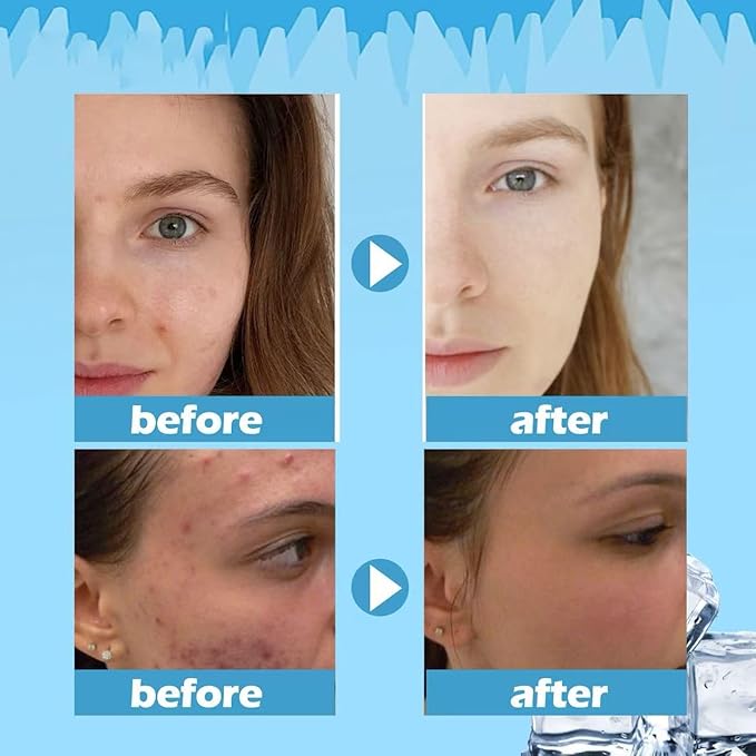 Water Sleeping Mask for Bright, Glowing Skin & Barrier Support;Moisturize And Hydrate Cream;Hydrating Emulsion Moisturizing Balm Nourishing Lotion