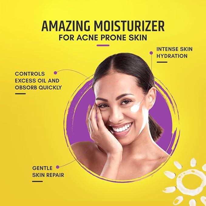Acmist Moisturizing Cream Gel for Oily & Acne-Prone Skin | Oil-Free, Non-Comedogenic, Quick Absorbing & Makeup Friendly | With Vitamin E, Aloe Vera & Squalane | For Men, Women & Teens | 100g/3.5 oz.