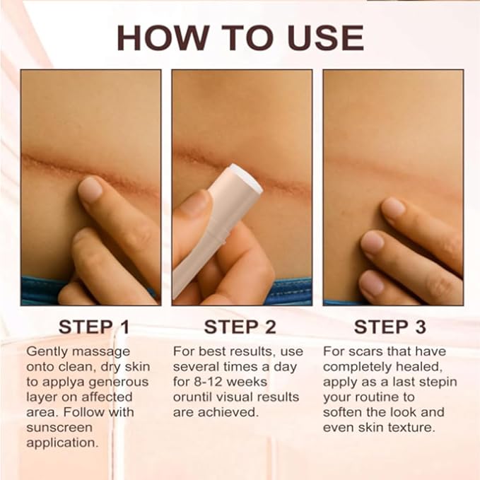 Scar Solution Stick, Silicone Scar Stick, 2pcs Moisturize Smoothing Skin Care Balm For Reducing Appearance Of Face Body, Suitable For All Skin Types