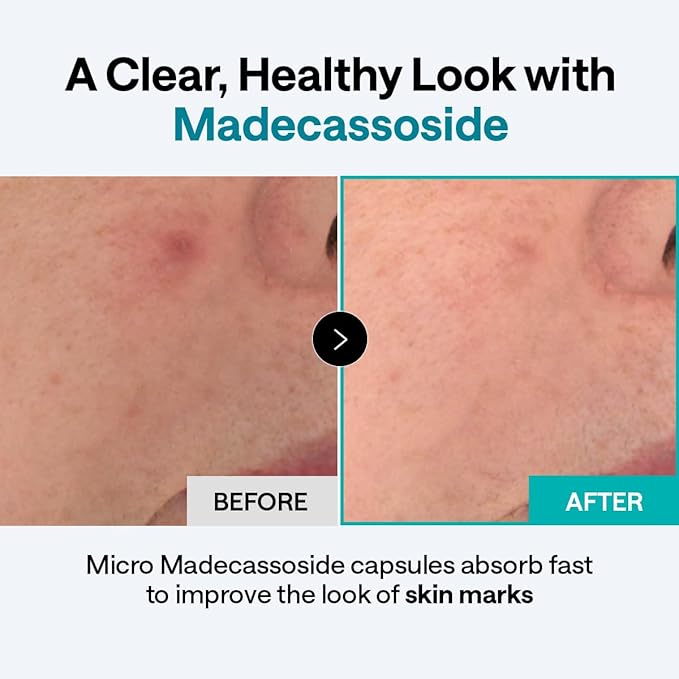Mediheal Madecassoside Blemish Repair Skincare Bundle – Toner Pads (100ct) + Repair Serum + Derma Cream | Centella Asiatica Tone Care, Hydration & Skin Barrier Support