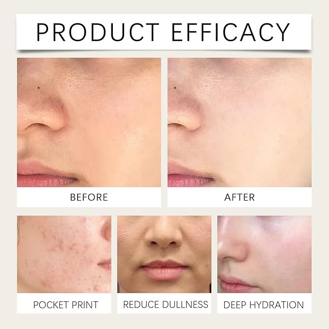 Milk Deep Hydrating Toner - Gentle Nourish, Lock Moisture, Bright Smooth Skin, Quick Absorb(2PCS)
