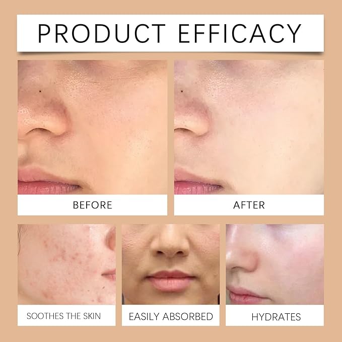 Hydrating Toner Spray - Moisturizing, Brightening & Oil-Control, Locks Moisture, Reduces Dryness, Universal Face Toner(2PCS)