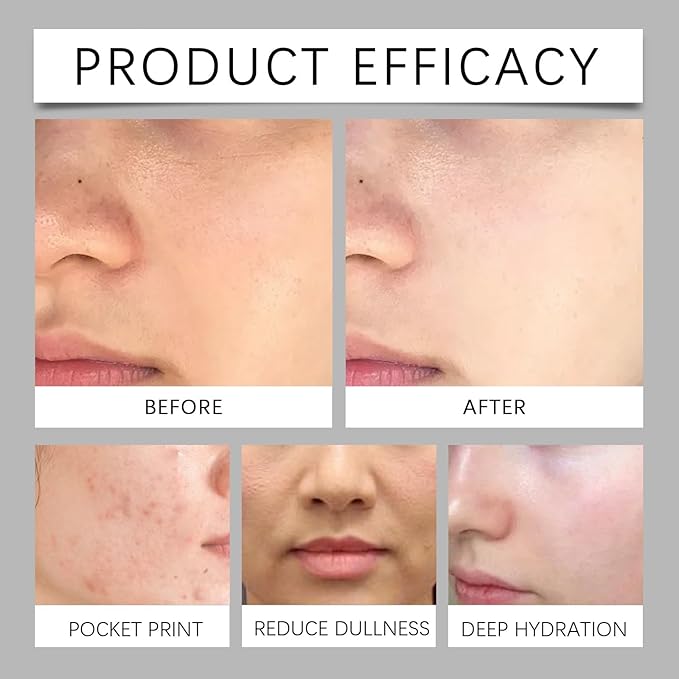 Niacinamide Hydrating Toner - Moisturizing, Brightening Facial Essence Water For Refreshing Skin & Long-Lasting Glow(2PCS)