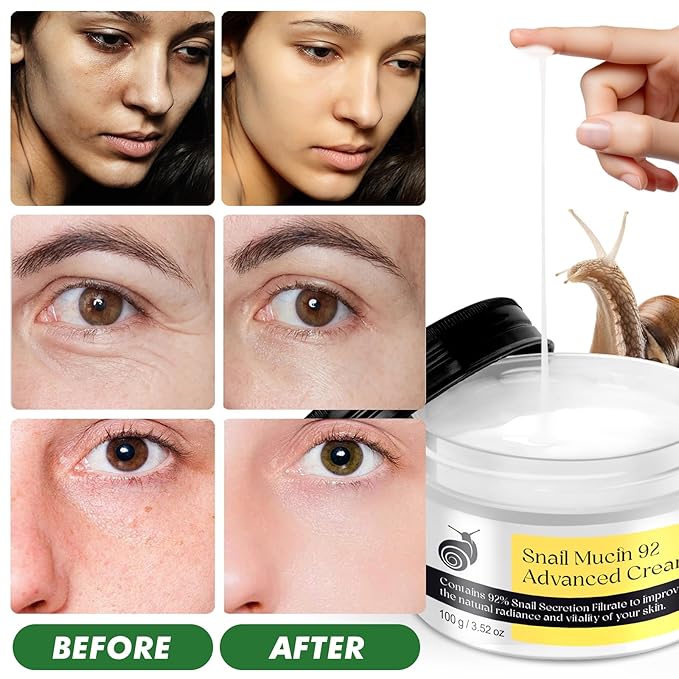 Snail Mucin Serum, Snail Mucin Moisturizer, Daily Face Serum for All Skin Types 1Pack 3.52oz