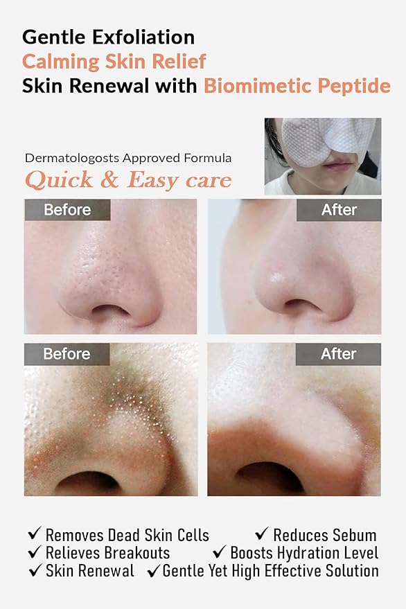 NIZNOT 01 4HA Skin Peel Daily Toner Pad – Clearer Skin Starts, 4HA CICA Gentle Daily Peeling, Deep Absorption Peptide 60 pads/170ml