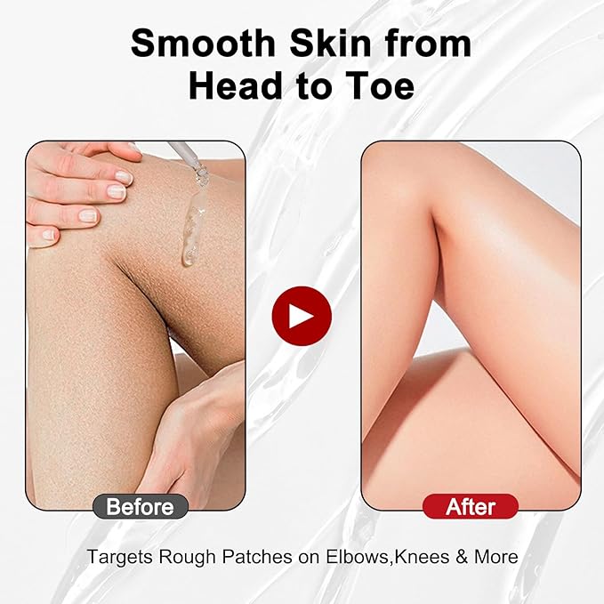 Gentle Exfoliating Serum with Hypochlorous Acid & Rice Extract - Daily Peel Solution for Smooth & Radiant Skin - 80ml