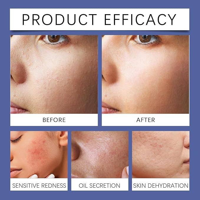 Hydrating Facial Spray - Deep Moisturizing Toner, Quick Absorption, Long-Lasting Hydration, Gentle Formula For Daily Skincare(2PCS)