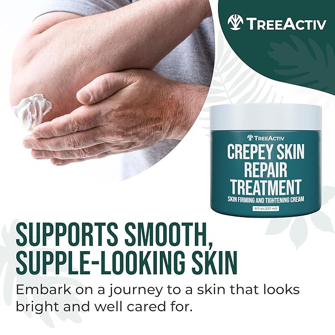 TreeActiv Crepey Skin Repair Cream, 8 oz Firming Body & Neck Cream with Hyaluronic Acid, Glycolic Acid & Shea Butter, Helps Crepey Skin Look Smoother, 500+ Uses