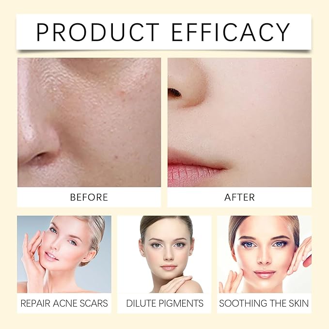 Gentle Nourishing Toner - Oil-Free, Hydrating & Soothing, Evens Skin Tone, Boosts Glow, Deep Moisture For Soft Smooth(1PCS)