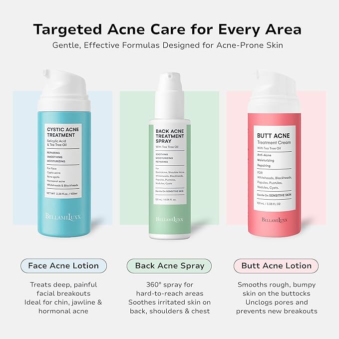 Cystic Acne Treatment for Face: Hormonal Acne Treatment Cream for Teens & Adults - Salicylic Acid & Tea Tree Oil Pimple Spot Remover - Anti-Acne Moisturizer Reduces Redness, Blemishes