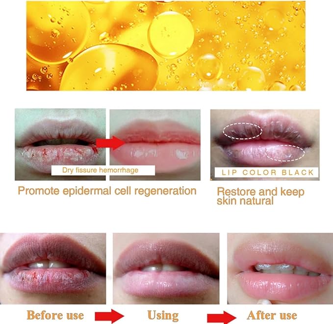 2PCS Lip Lightening for Dark Lips Lip for Smokers Dark Lip Treatment Lightening Cream for Pink Lips Lip Lightener for Smoker Lips Lip Lightening balm for Men and Women (Pink)