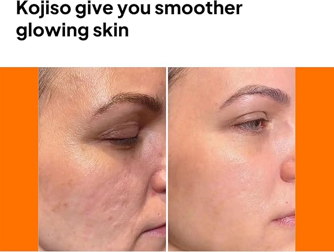 pH Lab Kojiso Set, Cleansing Bar, Toner Pad, Kojiso Skin Serum, Even Skin Tone