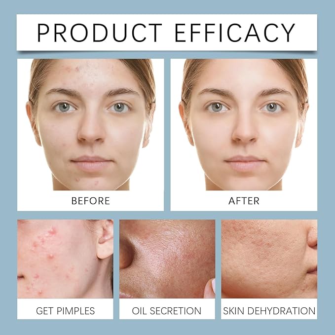Birch Sap Cleanser Gel & Toner - Brighten Facial Skin, Hydrating, Soothe Sensitive Redness, Oil-Control Daily Moisturizing Skincare(2PCS)