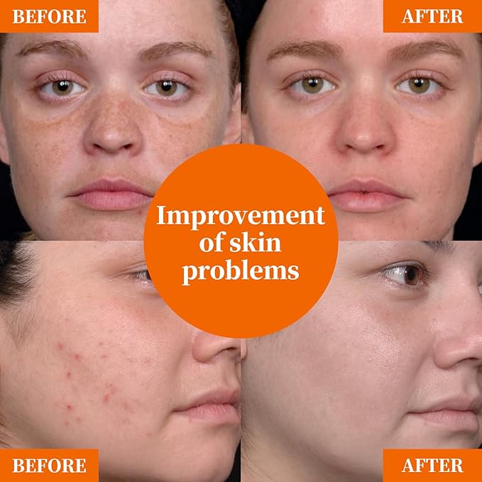 Vitamin C Facial Serum 20% with Hyaluronic Acid & Niacinamide – Anti-Aging Formula to Boost Collagen, Hydrate and Plump Skin, For All Skin Types – 1 Fl Oz