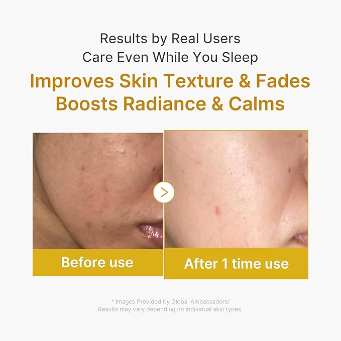 medicube Glass Skin Refining Duo at Night: Deep Vitamin C Golden Capsule Face Moisturizer and Turmeric Overnight Wrapping Peel Off Mask 2.0