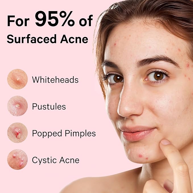 Sosky Pimple Patches for Face, FSA Eligible Invisible Hydrocolloid Acne Patches, Zit Sticker for Face and Skin, Pimple Sticker for Covering Zits, Blemishes with Salicylic Acid 57 Count