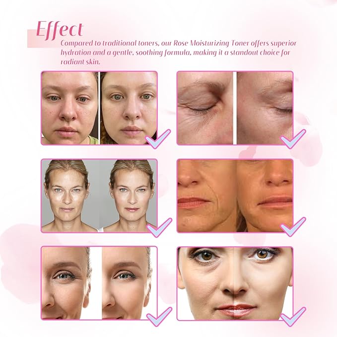 Rose Moisturizing Toner - Hydrating, Repairs Skin Barrier, Brightens Complexion, Non-Greasy, Suitable For All Skin Types(1PCS)