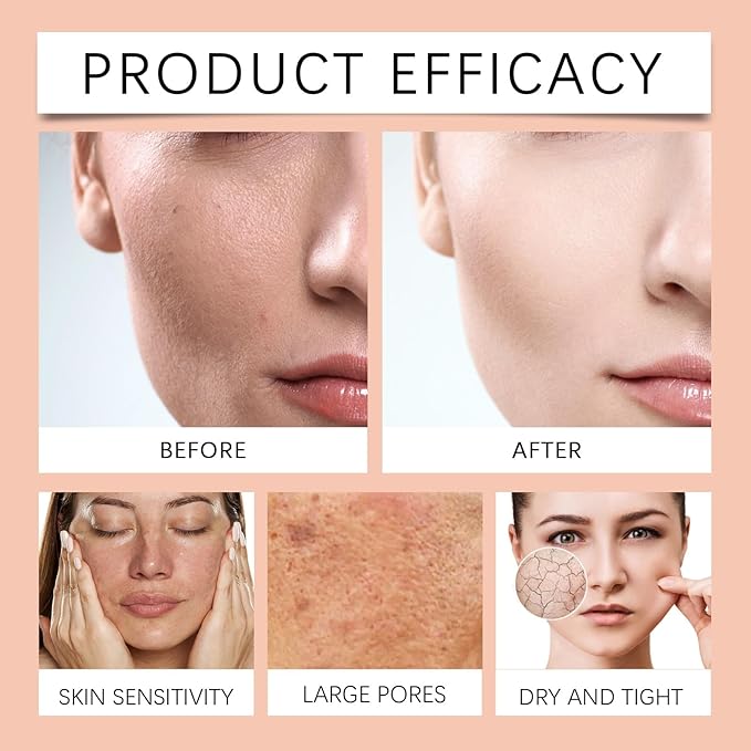 Hydrating Facial Toner - Moisturizes, Brightens, Balances Oil, Locks Moisture, Gentle For Soft Skin(1PCS)