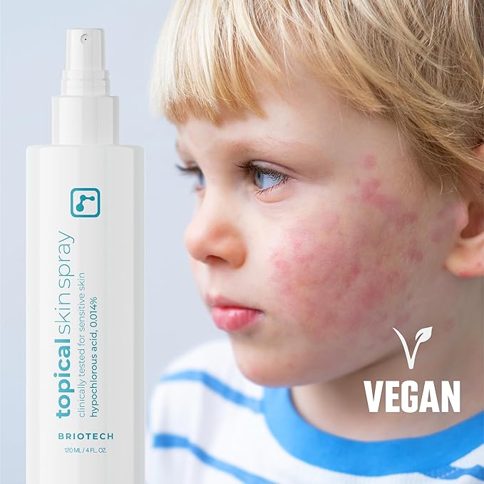 BRIOTECH Topical Skin Spray, Hypochlorous Acid Spray for Sensitive Skin, HOCl Facial Mist, Full Body Support Against Irritation, Calm Redness, Soothe Foot & Scalp, 8.5 oz (4 Pack)
