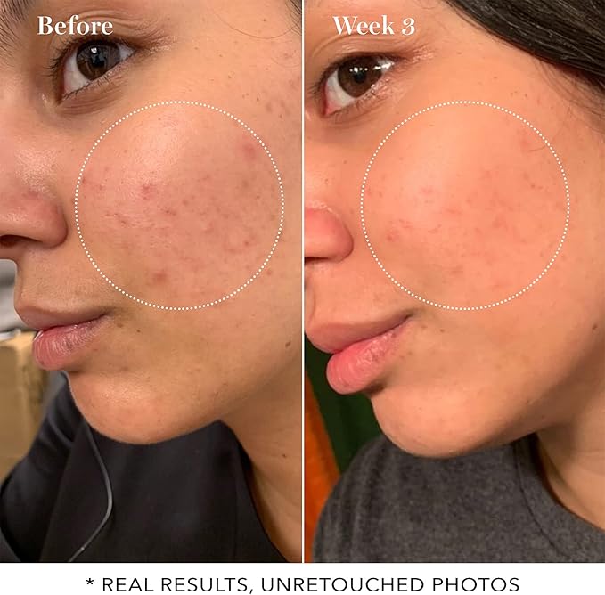 Saturday Skin Pore Clarifying Toner 10% Glycolic Acid&AHA Deep Cleansing and Pore Serum Active Treatment for Face 4% Glycolic Acid + Pore Care Complex Help Refine Skin’s Texture Sebum Control