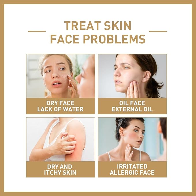 Hydrating Face Toner - Deep Moisturizing, Skin Barrier Repair, Anti-Aging, Minimizes Pores & Acne, Gentle Exfoliation(3PCS)