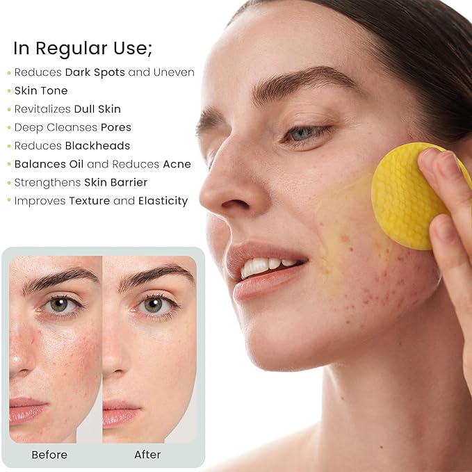 Kojic Acid Turmeric Exfoliating Cleansing Pads with Vitamin C in Cotton Pads, Dark Spots Remover & Deep Clean Pores for Face - 50 Pcs.