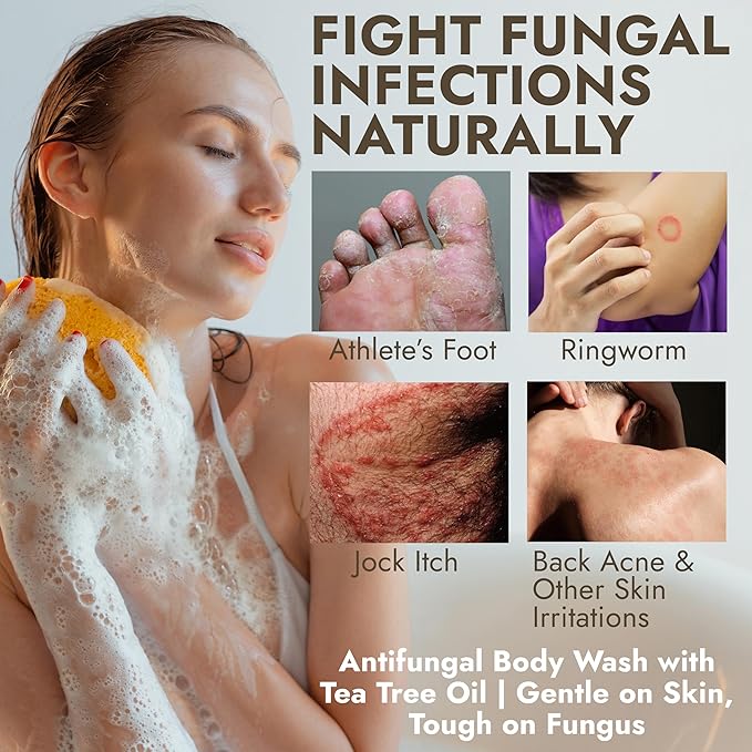 Antifungal Body Wash with Tea Tree Oil | Antifungal Soap Treats Ringworm, Back Acne, Eczema & Jock Itch | Antifungal Body Soap For Men And Women (16.9 oz)