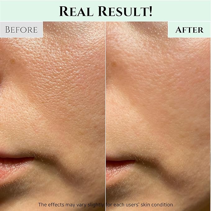 Beauty of Joseon Apricot Blossom Peeling Gel Soft Exfoliating Face with Green Plum Refreshing Cleanser Gel Type Deep Pore Cleansing