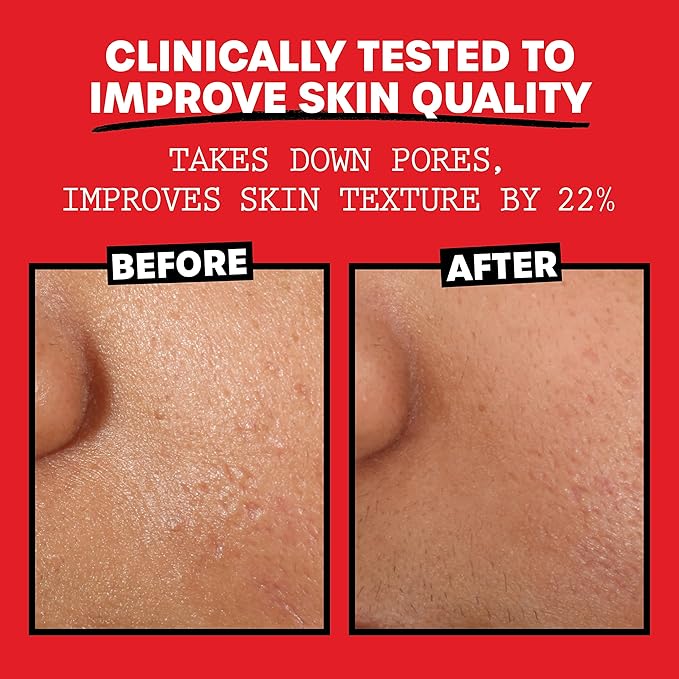 THAYERS Alcohol-Free Rose Petal Witch Hazel Facial Mist Toner, 3 Ounce + Trial Size Unscented Witch Hazel Facial Mist with Aloe Vera Toner, 3 Ounce
