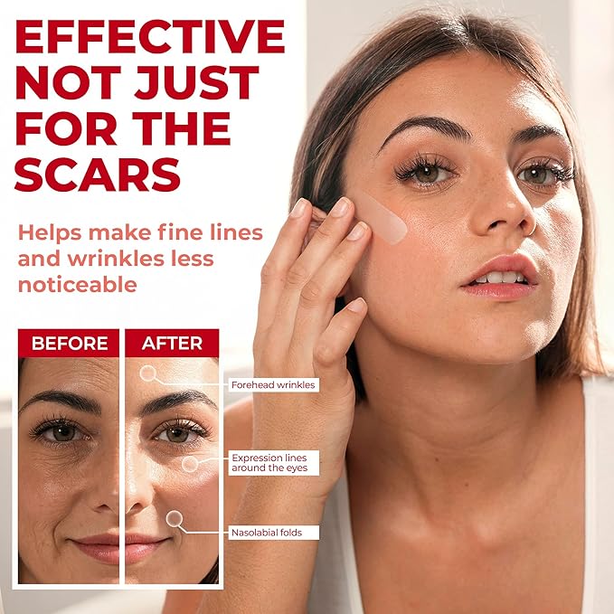 Medical Grade Silicone Scar Sheets - Transparent - 6pk (7”x1.6”) - Visible Difference on C-Section Scars - Reusable Silicone Sheets for Scars - Easy to Use C Section Scar Silicone Strips