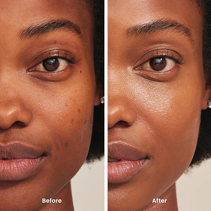 JOAH Perfect Complexion Under Eye Concealer and Hydrating Serum, Korean Makeup for Dark Circles and Puffiness, Peptide Serum with Medium Coverage, Cushion Tip Applicator