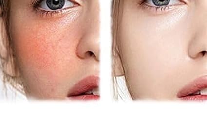 Turmeric Toner