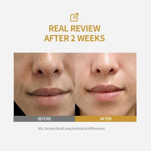 Fuente Silk Peptide Intensive Lifting Ampoule | Moisturizes, Firms and Lifts, Korean Anti-Aging Facial Essence, Smooths Wrinkles, Improves Elasticity | Christmas Gift for Women