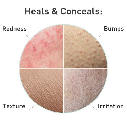PROcure Rosacare CC Hydrogel 2 fl oz – Color-Correcting Redness Relief Gel with Hyaluronic Acid, Cucumber & Licorice Root for Sensitive Skin