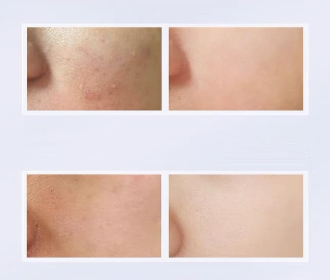 1PC Plift Face Toner, Soothing Fine Lines and Redness, 150ml