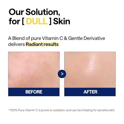 Mediheal Vitamin C Pad & Serum Skin Care Duo Set for Skin Clarity & Radiance – Vitamide Toner Pads (100 Count)+ Vitamin C Serum (1.35 fl.oz)