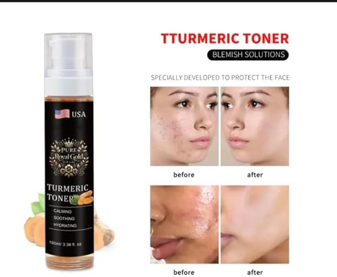 Pure Royal Gold Turmeric Facial Toner, 3.38 fl oz, Calming and Hydrating for Acne-Prone Skin