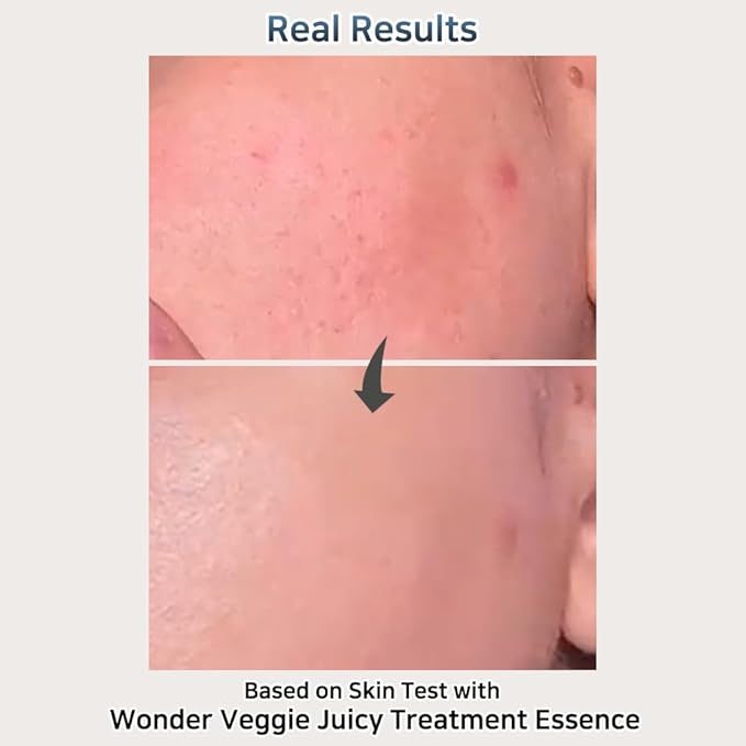 Hersteller Wonder Veggie Juicy Treatment Essence Toner – Korean Hydrating Face Toner with Kale Extract – Vegan, Non-Irritating, for Sensitive Skin – 5.07 fl oz K-Beauty Skincare