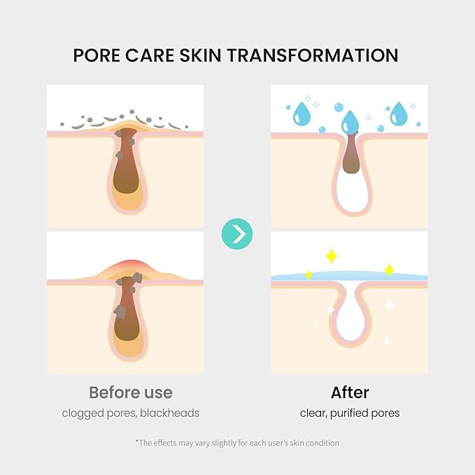 coxir Tea Tree Pore & Sebum Toner | Oil Balance, Pore Minimizer, Sebum Control | Paraben Free, Cruelty Free, Korean Skin Care[150ml/5.07 fl.oz]