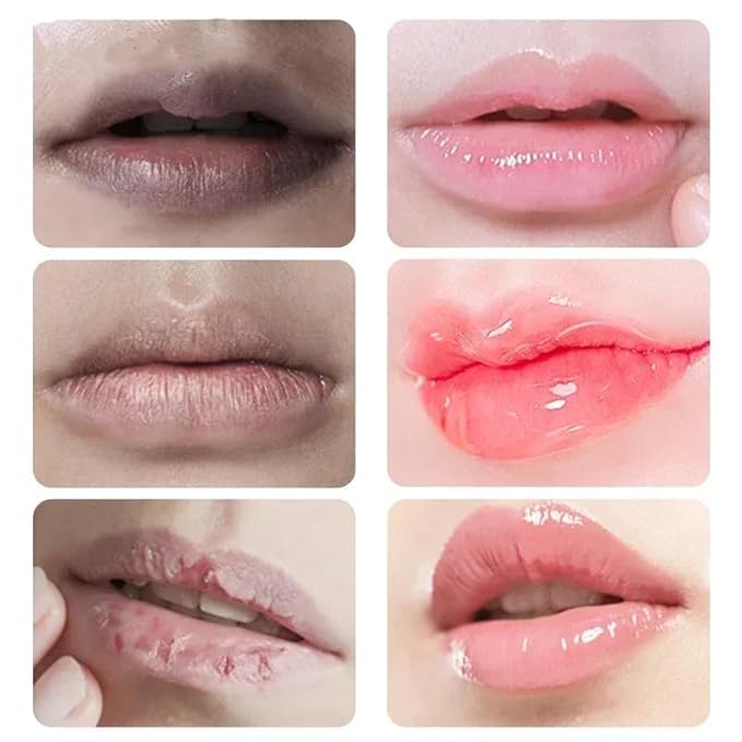 2PCS Lip Lightening for Dark Lips Lip for Smokers Dark Lip Treatment Lightening Cream for Pink Lips Lip Lightener for Smoker Lips Lip Lightening balm for Men and Women (Orange)