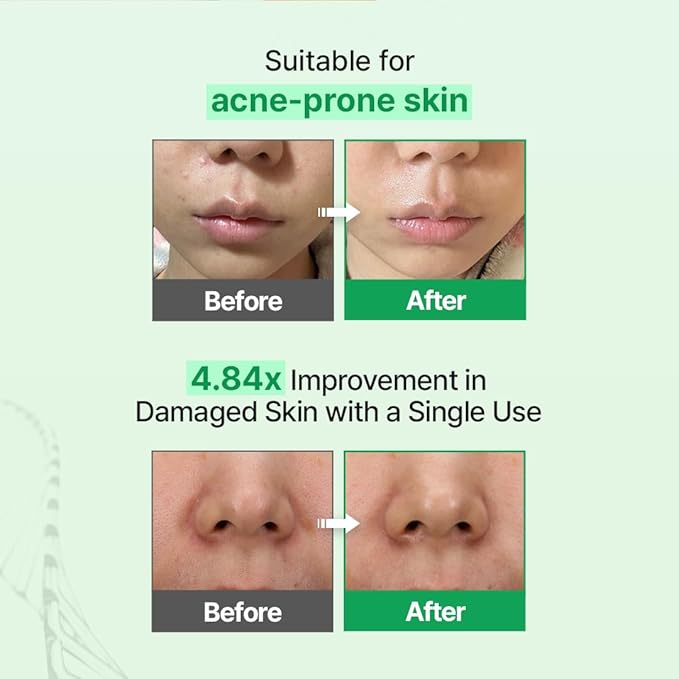 Zipiderm EGF Skin Barrier Toner & Ampoule Duo – Milky Ceramide Toner + Hydrating Repair Ampoule for Redness, Dryness & Damaged Skin | Bio-EGF, PDRN, Ceramides | Korean Skincare Barrier Routine Set