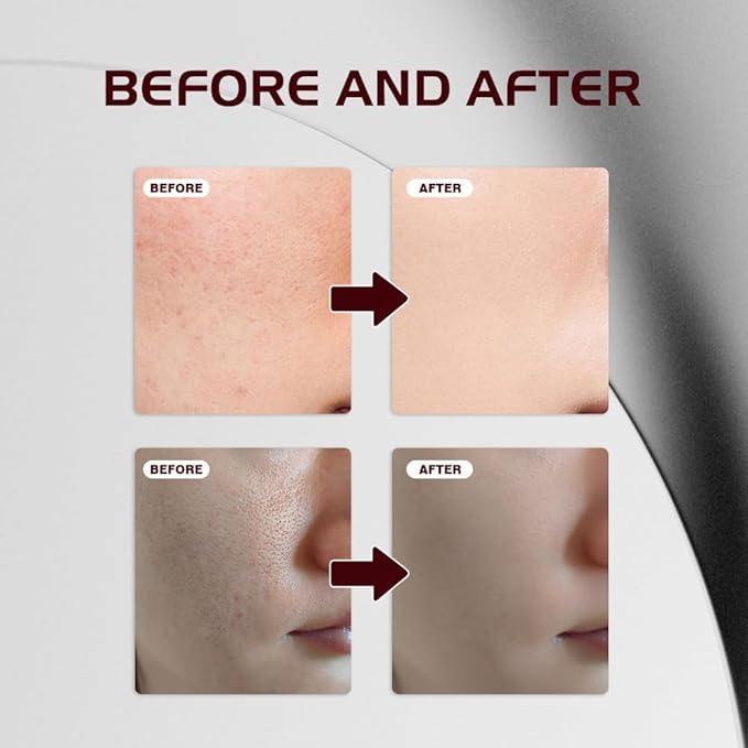 2PCS Facial Brightening Essence Essential Oil Is Suitable for Dry Skin to Maintain Skin Oil Balance and Moisturize