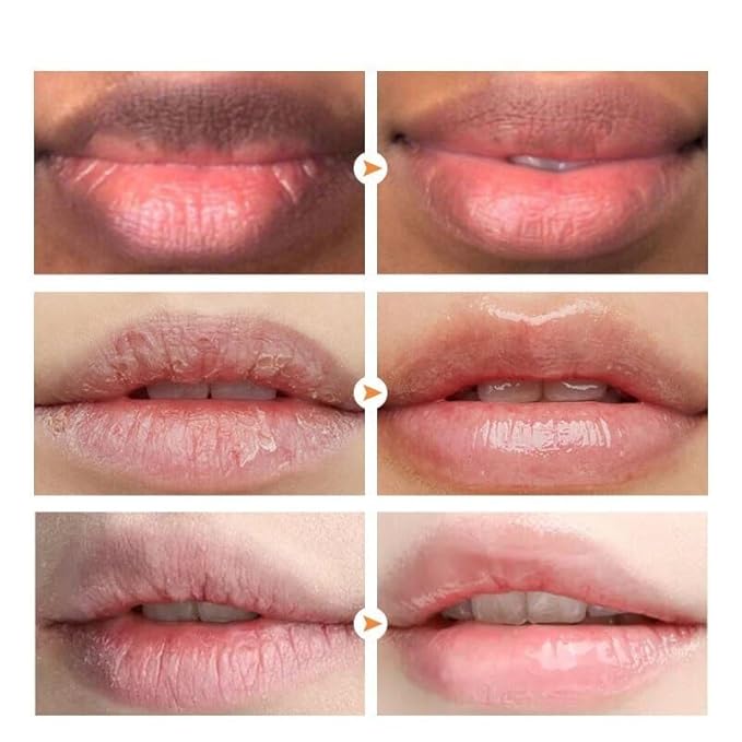 2PCS Lip Lightening for Dark Lips Lip for Smokers Dark Lip Treatment Lightening Cream for Pink Lips Lip Lightener for Smoker Lips Lip Lightening balm for Men and Women (Pink)