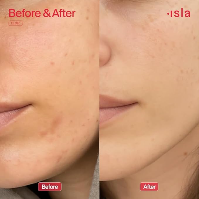 ISLA The Elixir No-Acid Toner, Brightens + Reduces Redness, Wildberry, Glycerin & Botanical Extracts, Hydrates, Evens Tone & Strengthens Skin Barrier, Fragrance-Free, Made in Australia, 4.05 fl oz