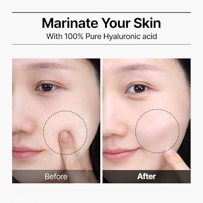 WELLAGE Real Hyaluronic Blue Ampoule 100, Korean Hydrating Serum for Face, Skin Firming Hyaluronic Acid Deep Moisturizing Serum with Panthenol, PDRN, 2.54 Fl Oz_R